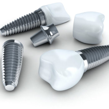 Dental implant materials