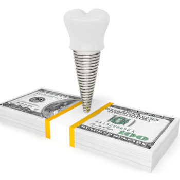 Cost of dental concept. Tooth Implant With Money on a white background