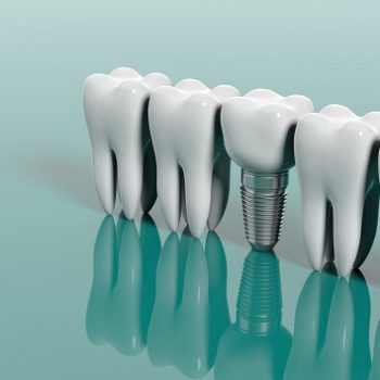 Teeth and dental implant isolated on green background. 3d illustration